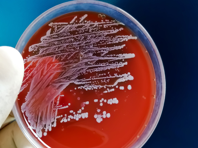 Genetyczna podatność na infekcje bakteryjne